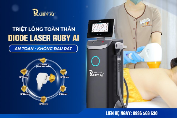 Dịch vụ triệt lông toàn thân công nghệ Dior Laser Ruby AI